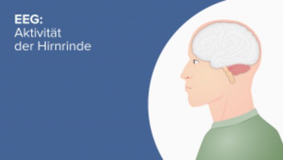 EEG: Aktivität der Hirnrinde